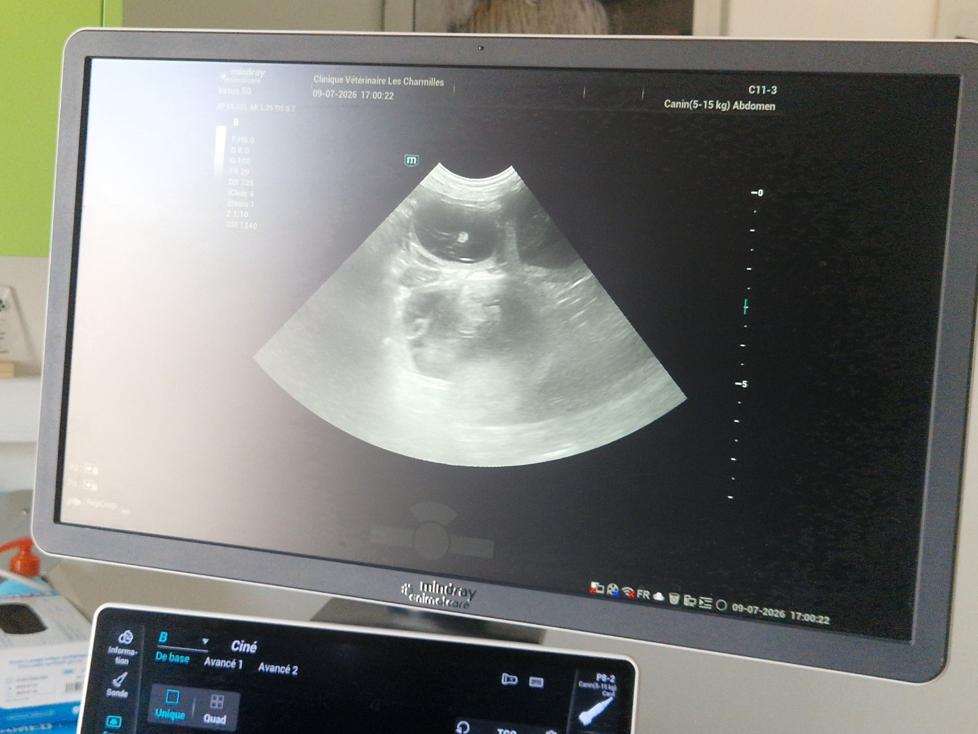 Des bébés prévu pour début août